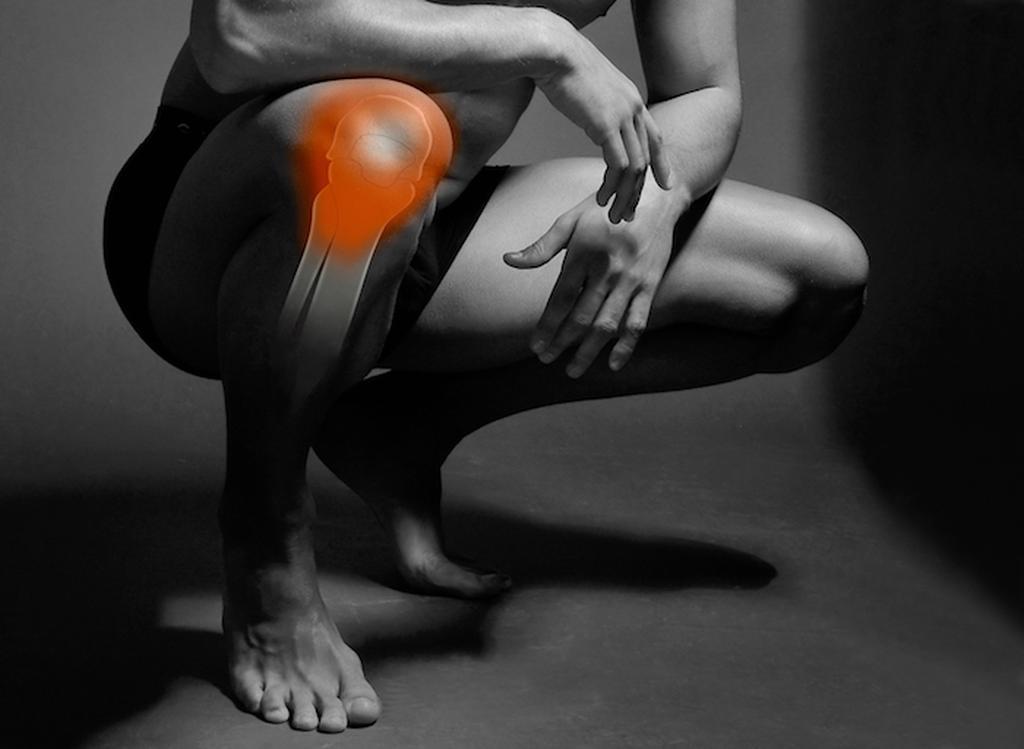 When Does a Meniscus Tear Require Knee Surgery?