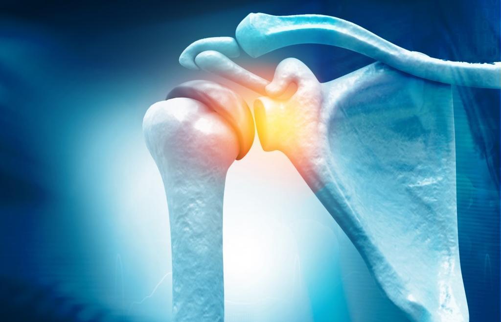 Four Signs That You’ve Torn Your Rotator Cuff